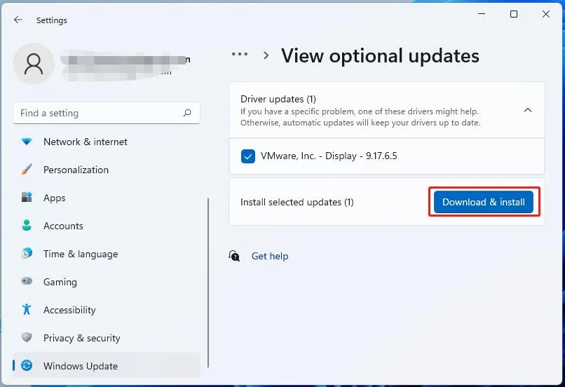 Download and Install button