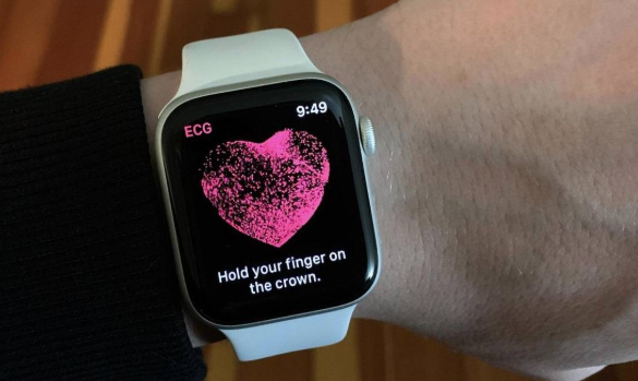 Apple’s Smartwatch