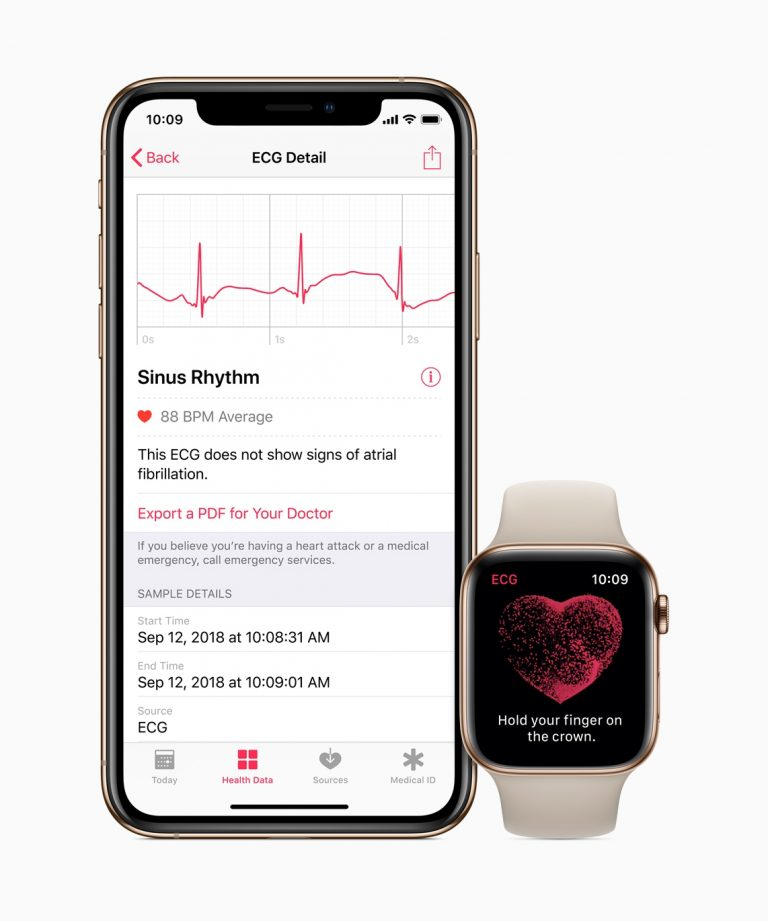 ECG details on apple watch