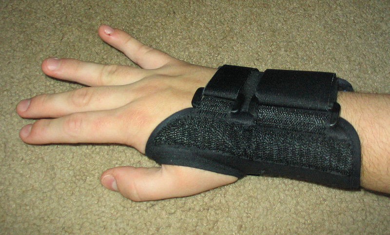 Carpal Tunnel Syndrome